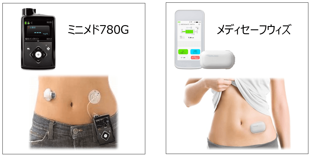 ミニメド780Gとメディセーフウィズの見た目と腹部に着用している様子